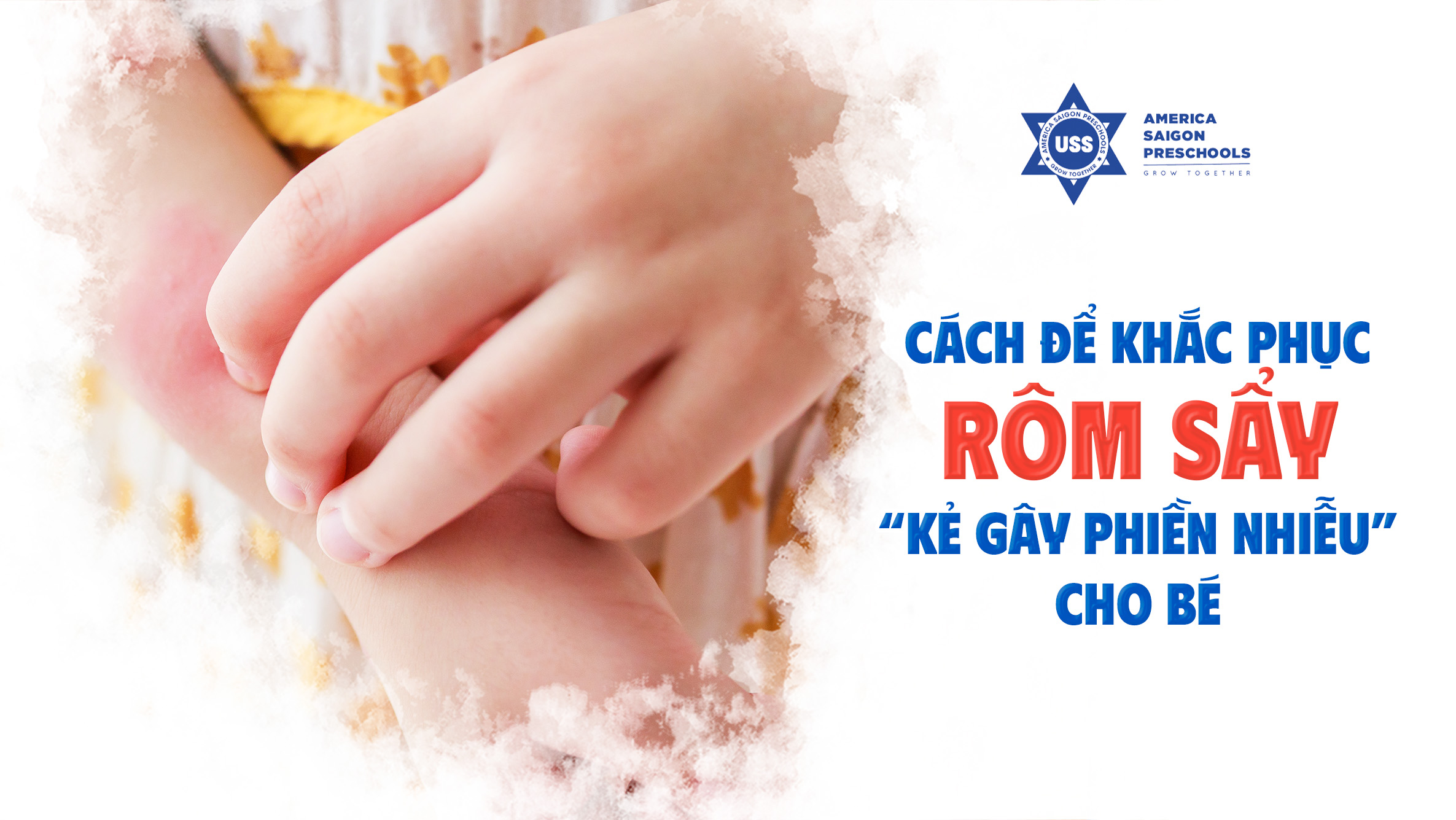 CACH DE KHAC PHUC ROM SAY